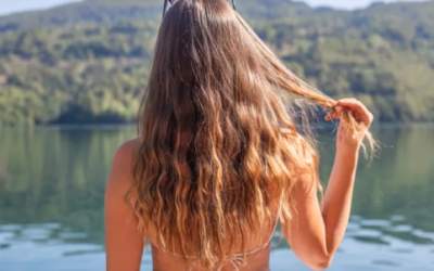 HAIR LOSS IN WOMEN