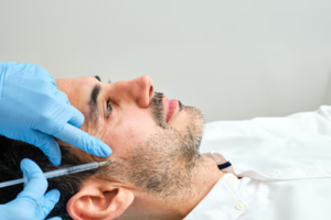 Avoid These Mistakes 10 Days After Your Beard Transplant