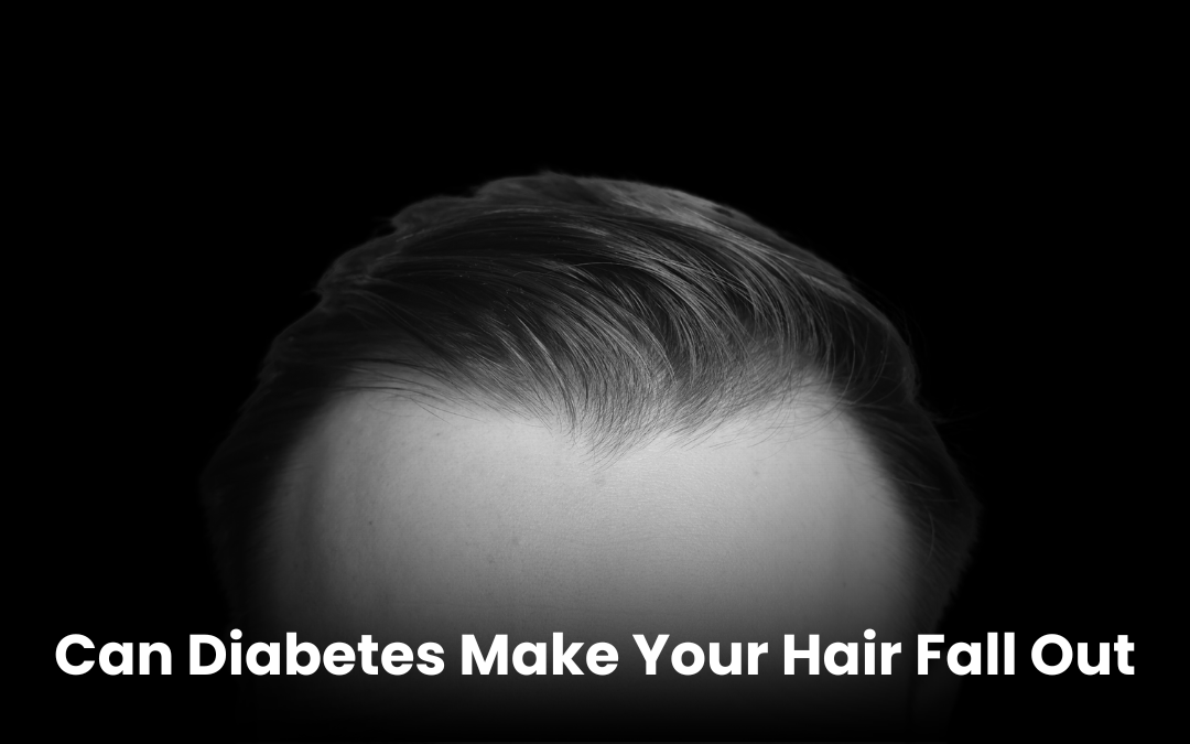 Close-up of a person’s hair with the question ‘Can Diabetes Make Your Hair Fall Out’ indicating a health concern related to diabetes and hair loss.