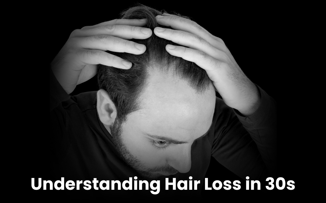 Understanding Hair Loss in 30s