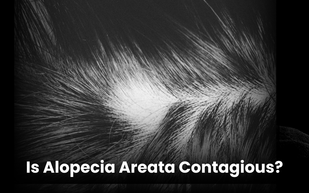 Is Alopecia Areata Contagious?