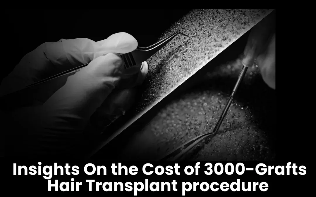 3000 Grafts Hair Transplant Cost In India