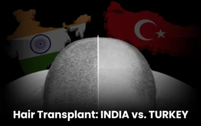 Hair Transplant India vs. Turkey