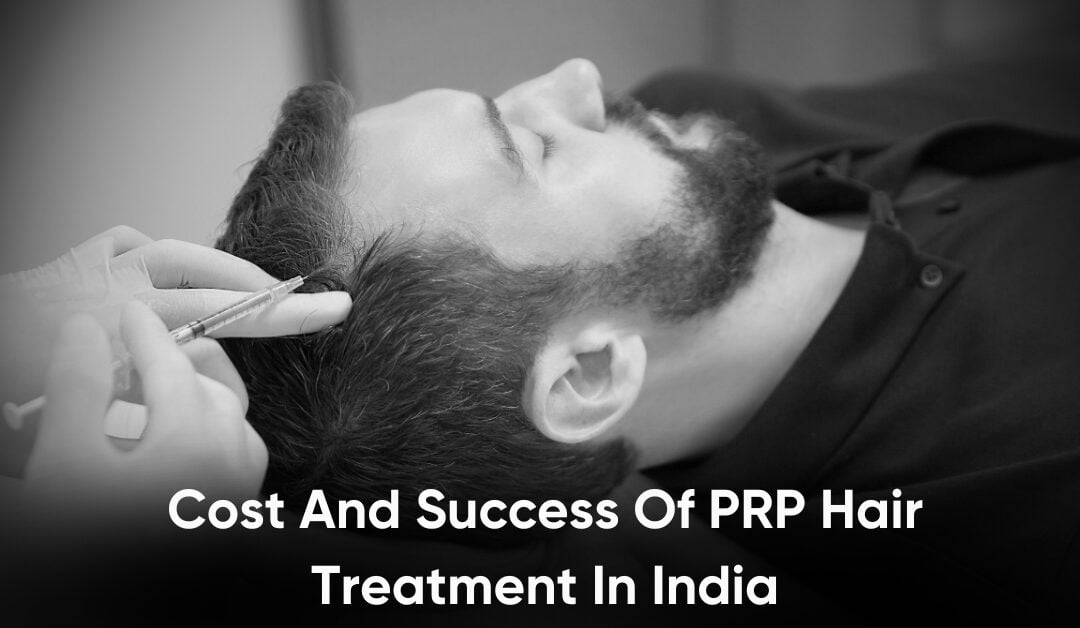 Cost And Success Of PRP Hair Treatment In India