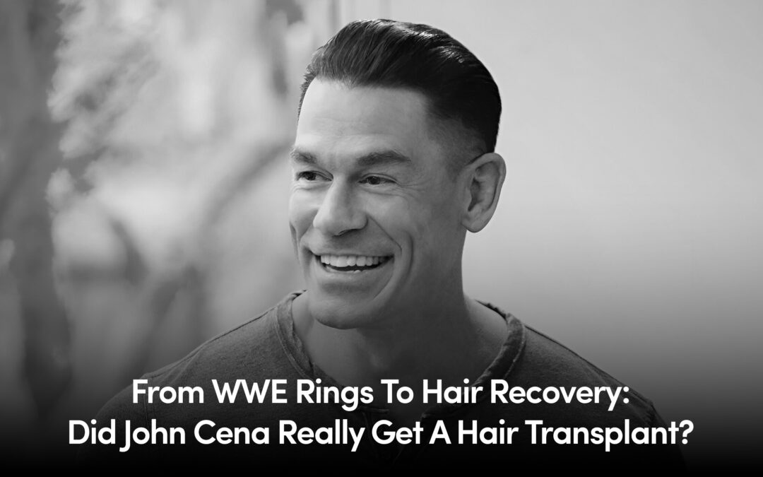 john cena hair transplant