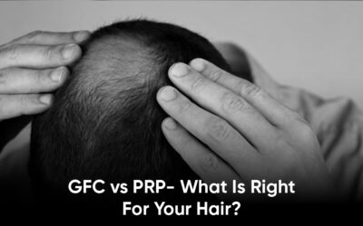 GFC vs PRP- What is Right for Your Hair?
