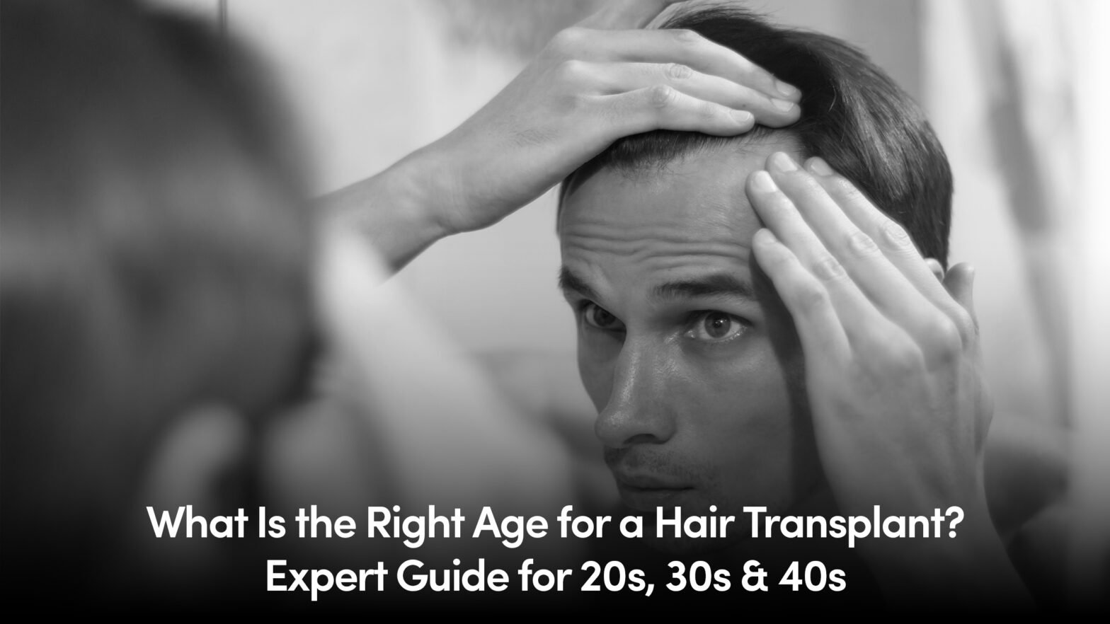 What Is the Right Age for a Hair Transplant? Expert Guide for 20s, 30s & 40s