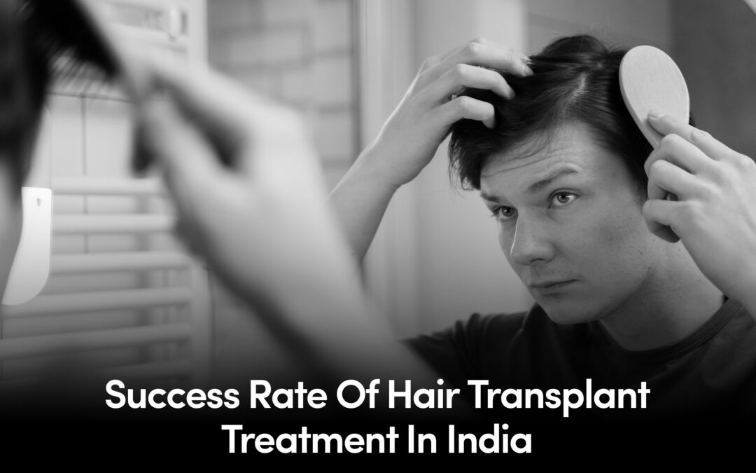 Success rate of Hair transplant treatment in India: Expert’s Analysis