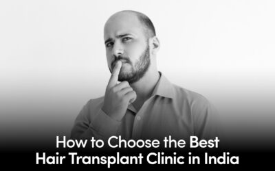 How to Choose the Best Hair Transplant Clinic in India