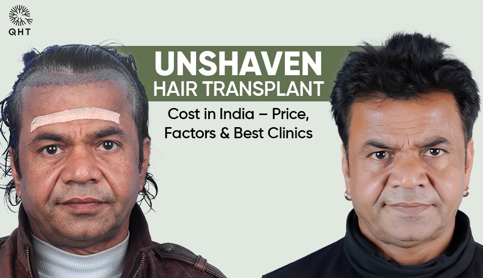 Unshaven hair transplant