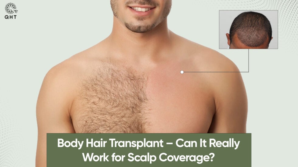 Body Hair Transplant – Can It Really Work for Scalp Coverage?
