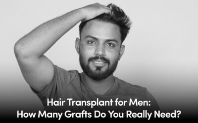 Hair Transplant for Men: How Many Grafts Do You Really Need?