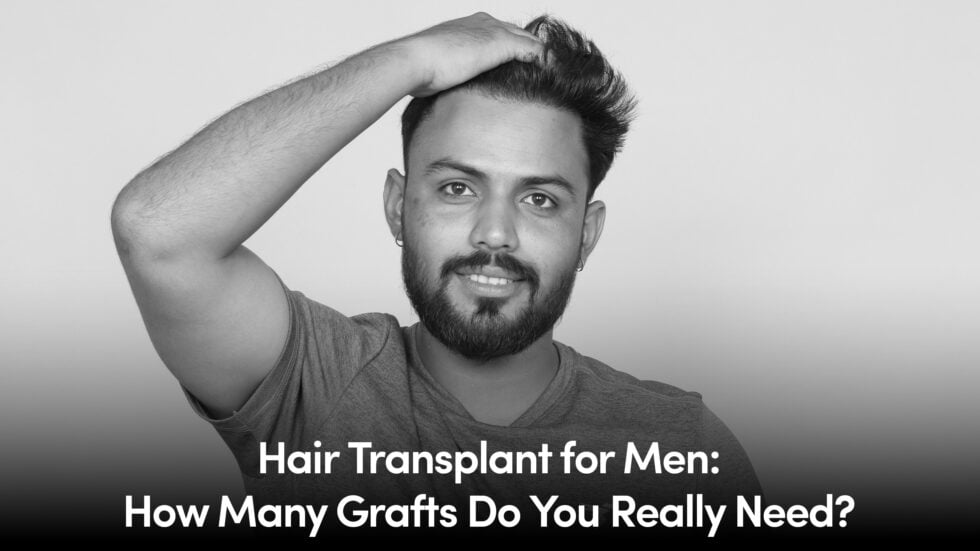 Hair Transplant for Men: How Many Grafts Do You Really Need?