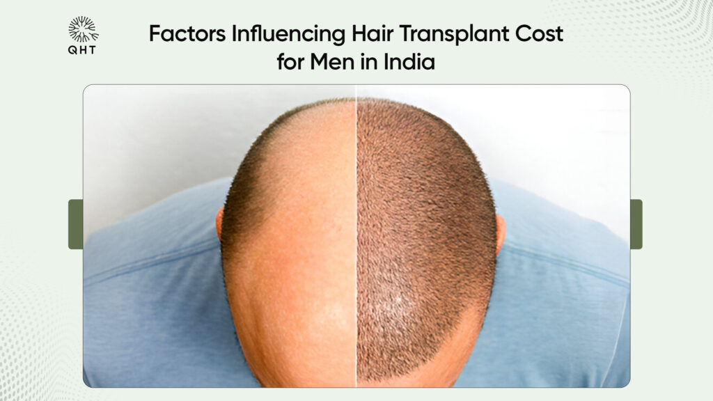 Factors influencing hair transplant cost for men in India, showcasing a comparison of baldness and hair growth after transplant.