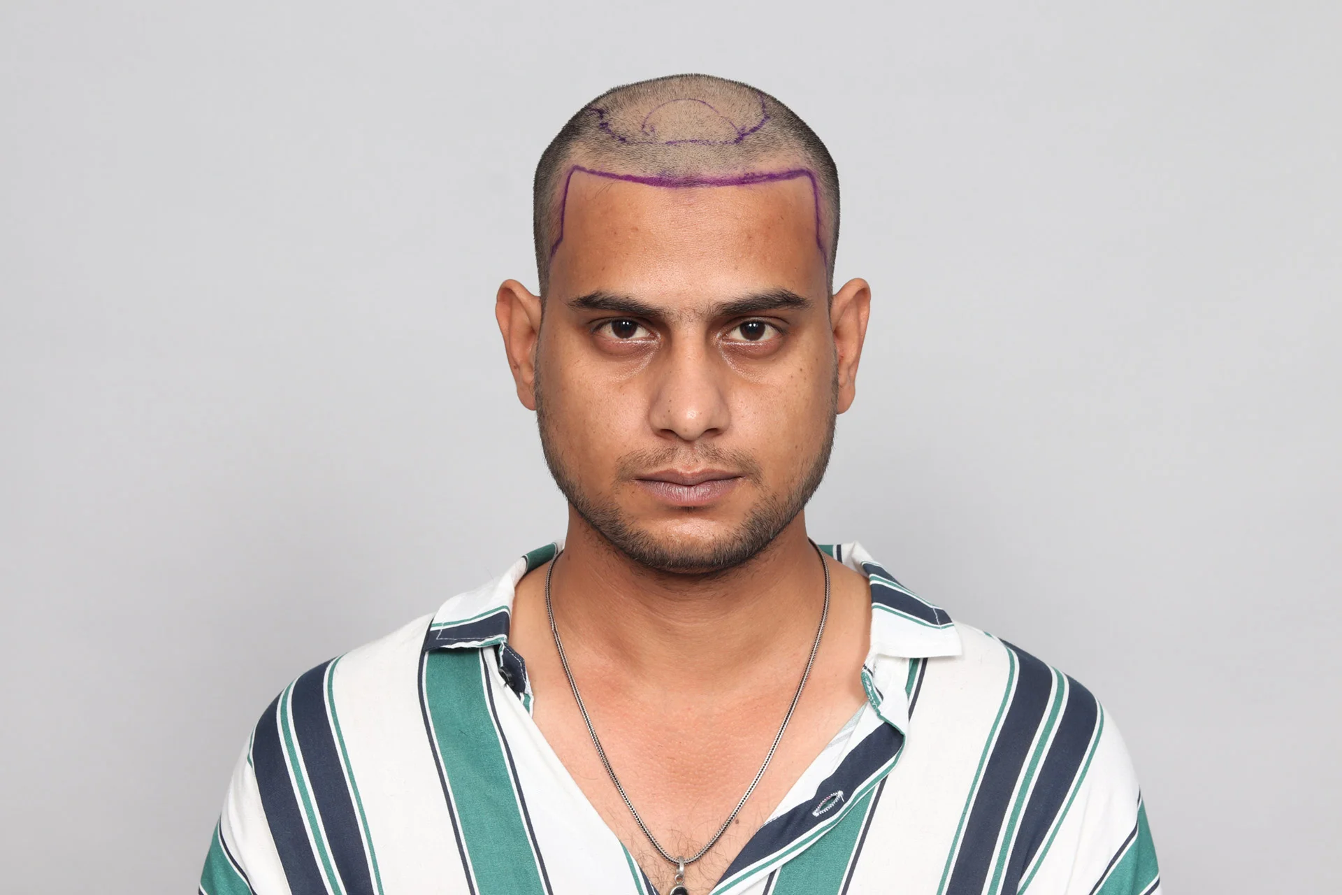 Ht Mehtab Mohd. Mehtab - QHT Clinic