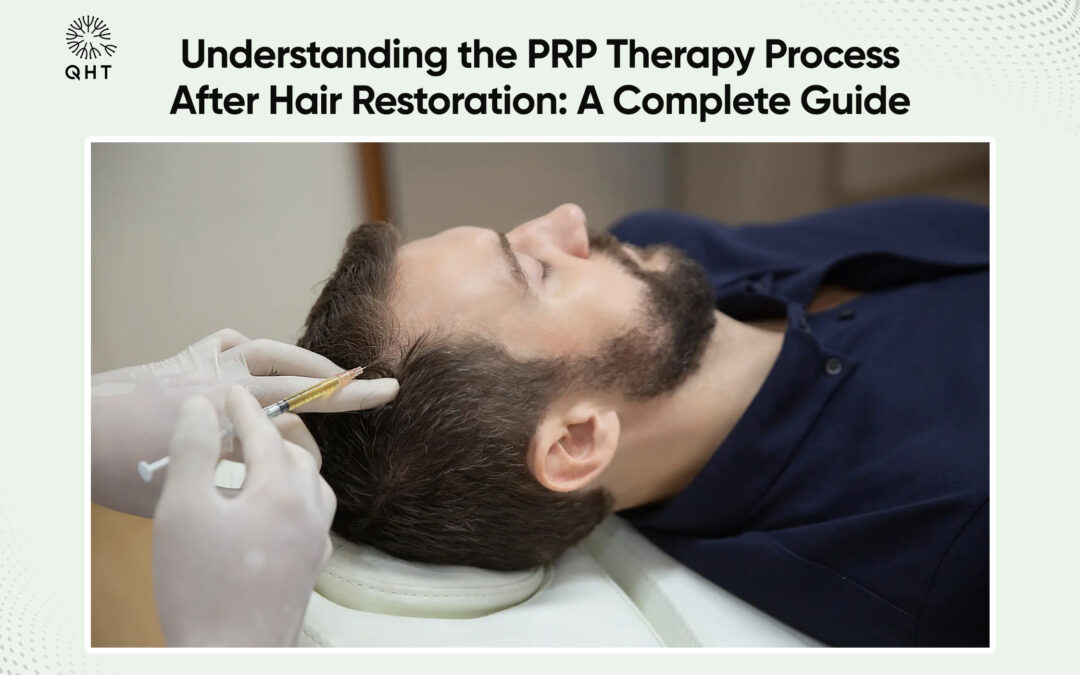 Understanding the PRP Therapy Process After Hair Restoration: A Complete Guide