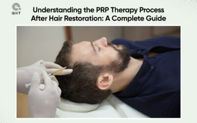 Understanding the PRP Therapy Process After Hair Restoration: A Complete Guide