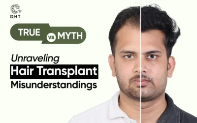 Truth or Myth? Unraveling Hair Transplant Misunderstandings