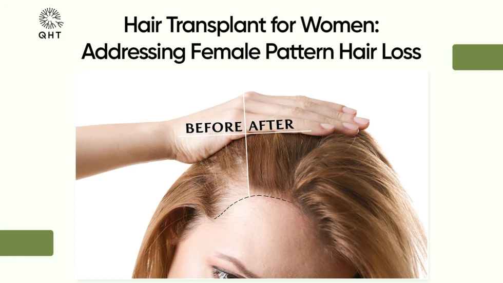 Hair Transplant for Women: Addressing Female Pattern Hair Loss