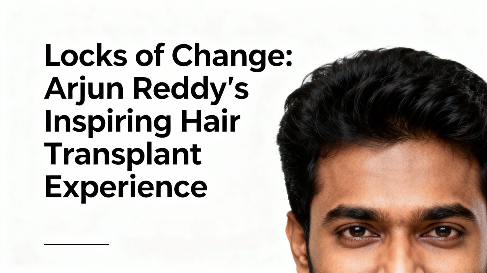 Locks of Change: Arjun Reddy’s Inspiring Hair Transplant Experience