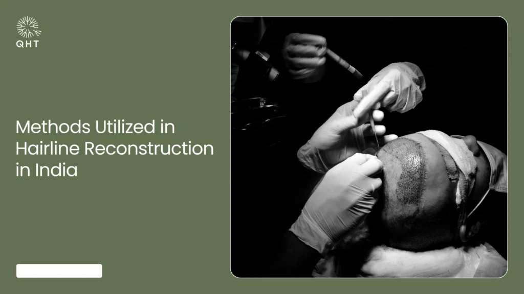 Surgeons performing hairline reconstruction using advanced methods for natural results in India.