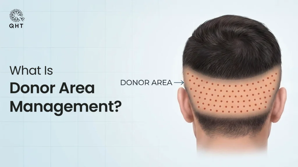 What Is Donor Area Management?