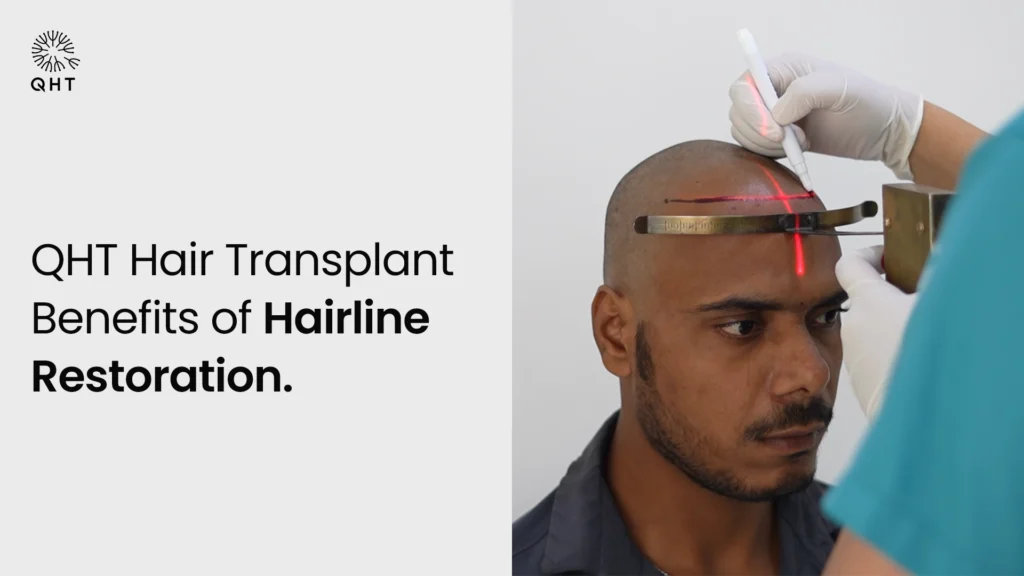 QHT Hair Transplant Procedure for Hairline Restoration