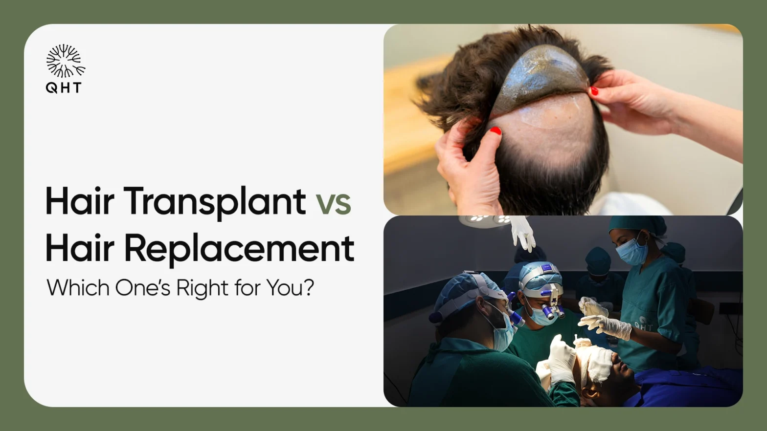 Hair Transplant vs Hair Replacement: Which One’s Right for You?