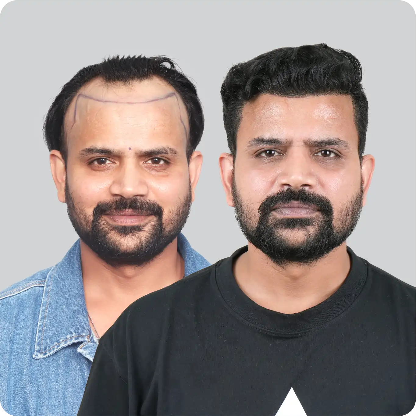 Natural-Appearing Results